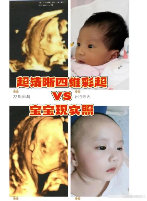 小红书Ai绘画项目解析,不可多得的创业商机